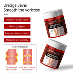 Varicose Veins Relief Cream